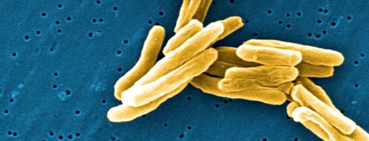 Un “bocado” contra la tuberculosis
