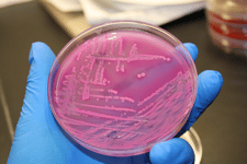 Figura 1. Crecimiento de E. coli en placa.