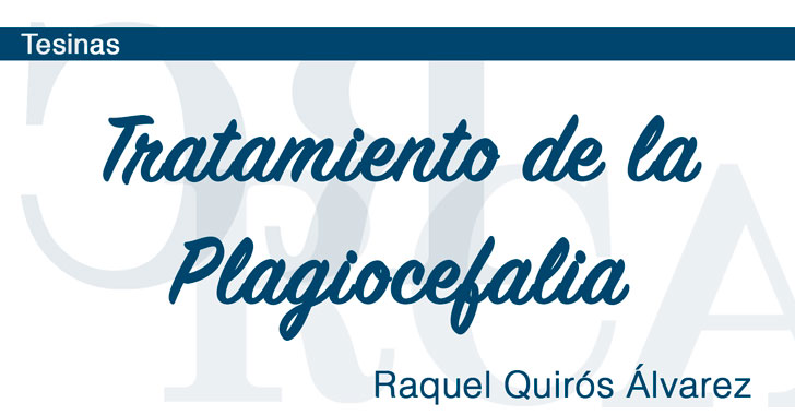 Tratamiento de la Plagiocefalia
